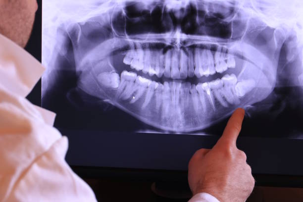 Best Emergency Root Canal Treatment in Royal Pines, NC